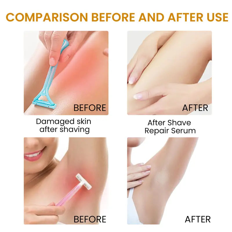 Irritation Relief Bikini Area Hair Serum